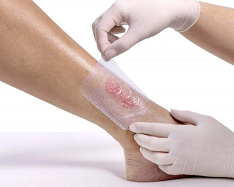 Dr. Diego García Caballero atención especializada en pie diabético, angiología, cirugía vascular, heridas, quemaduras y terapia VAC