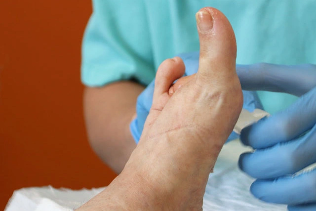 Dr. Diego García Caballero atención especializada en pie diabético, angiología, cirugía vascular, heridas, quemaduras y terapia VAC