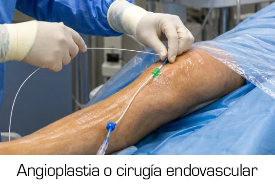 Dr. Diego García Caballero atención especializada en pie diabético, angiología, cirugía vascular, heridas, quemaduras y terapia VAC