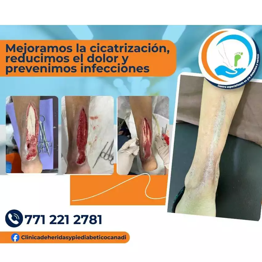 Dr. Diego García Caballero atención especializada en pie diabético, angiología, cirugía vascular, heridas, quemaduras y terapia VAC