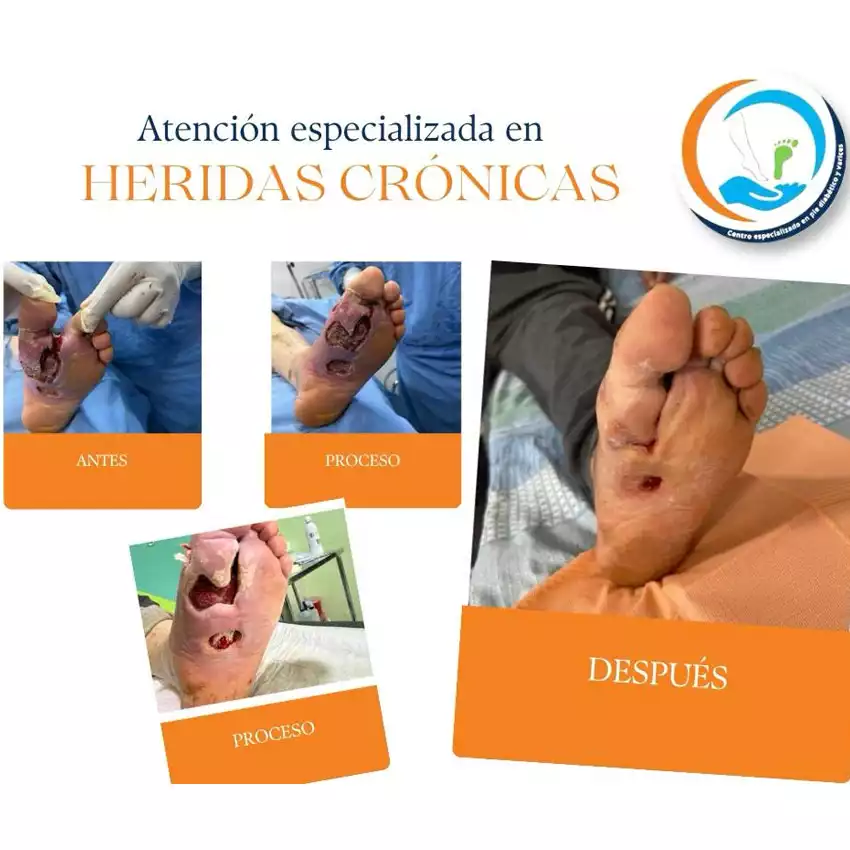 Dr. Diego García Caballero atención especializada en pie diabético, angiología, cirugía vascular, heridas, quemaduras y terapia VAC