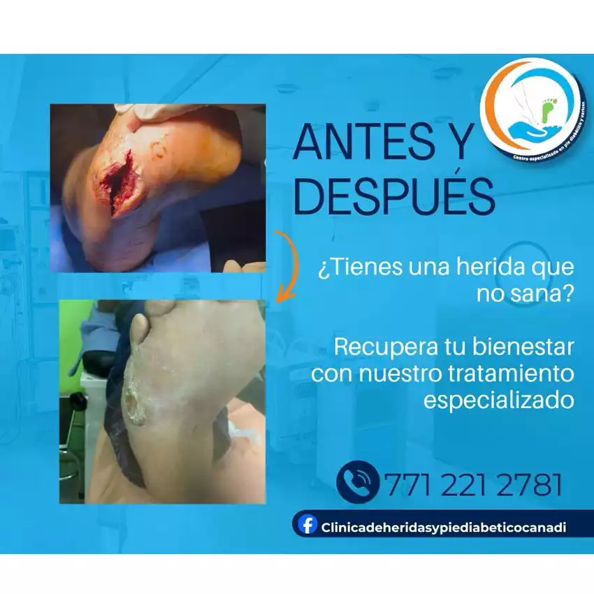 Dr. Diego García Caballero atención especializada en pie diabético, angiología, cirugía vascular, heridas, quemaduras y terapia VAC