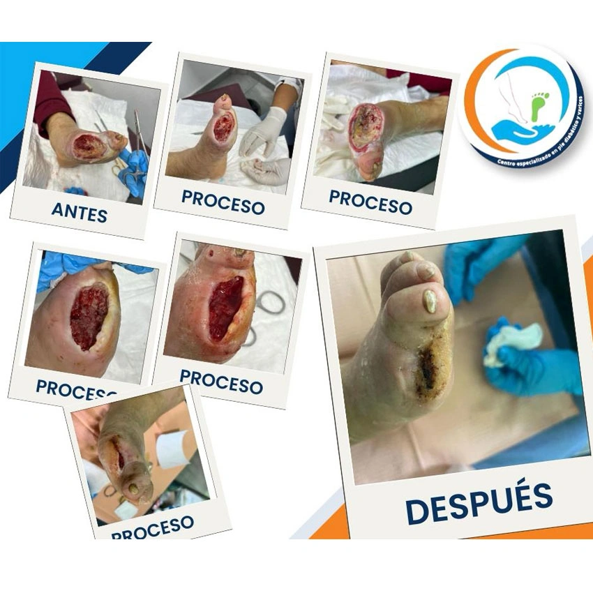 Dr. Diego García Caballero atención especializada en pie diabético, angiología, cirugía vascular, heridas, quemaduras y terapia VAC