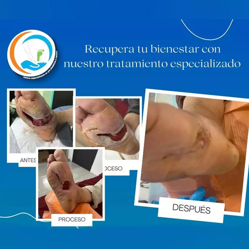 Dr. Diego García Caballero atención especializada en pie diabético, angiología, cirugía vascular, heridas, quemaduras y terapia VAC