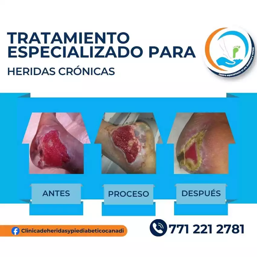 Dr. Diego García Caballero atención especializada en pie diabético, angiología, cirugía vascular, heridas, quemaduras y terapia VAC