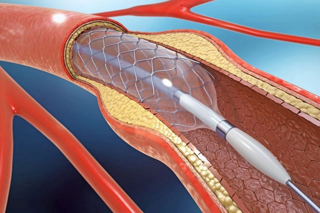 Dr. Diego García Caballero atención especializada en pie diabético, angiología, cirugía vascular, heridas, quemaduras y terapia VAC