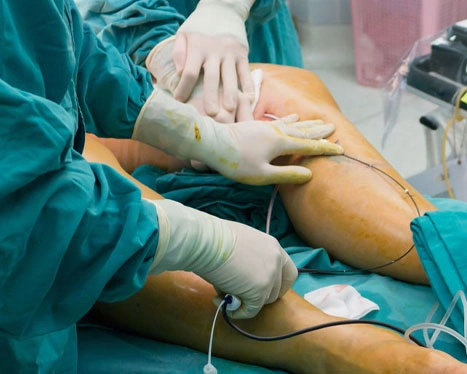 Dr. Diego García Caballero atención especializada en pie diabético, angiología, cirugía vascular, heridas, quemaduras y terapia VAC
