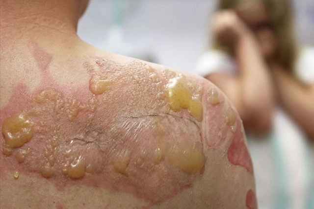 Dr. Diego García Caballero atención especializada en pie diabético, angiología, cirugía vascular, heridas, quemaduras y terapia VAC