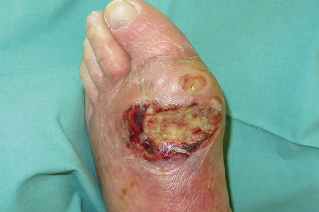 Dr. Diego García Caballero atención especializada en pie diabético, angiología, cirugía vascular, heridas, quemaduras y terapia VAC