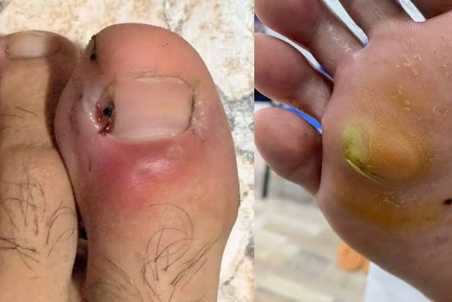 Dr. Diego García Caballero atención especializada en pie diabético, angiología, cirugía vascular, heridas, quemaduras y terapia VAC