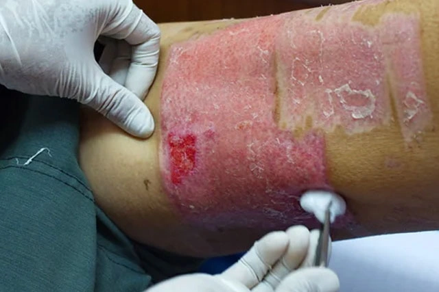 Dr. Diego García Caballero atención especializada en pie diabético, angiología, cirugía vascular, heridas, quemaduras y terapia VAC