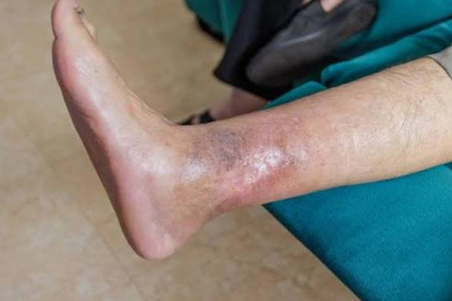 Dr. Diego García Caballero atención especializada en pie diabético, angiología, cirugía vascular, heridas, quemaduras y terapia VAC