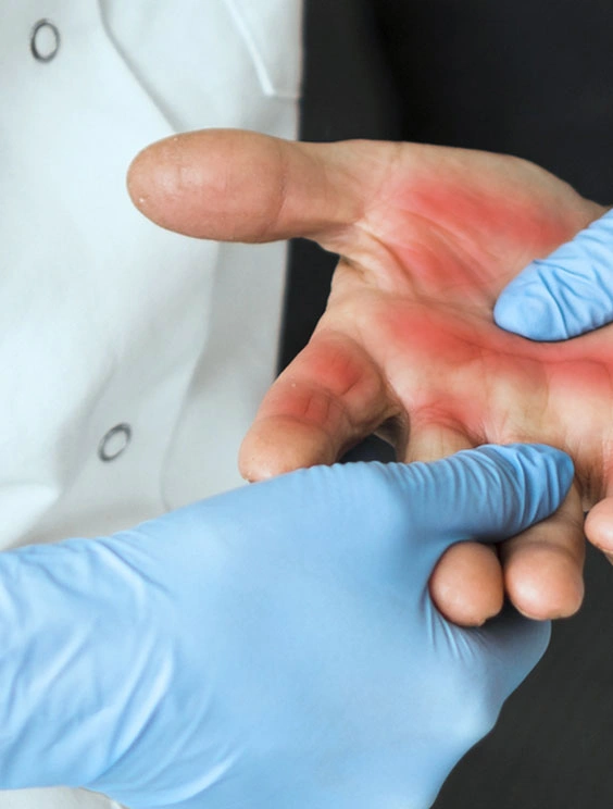Dr. Diego García Caballero atención especializada en pie diabético, angiología, cirugía vascular, heridas, quemaduras y terapia VAC