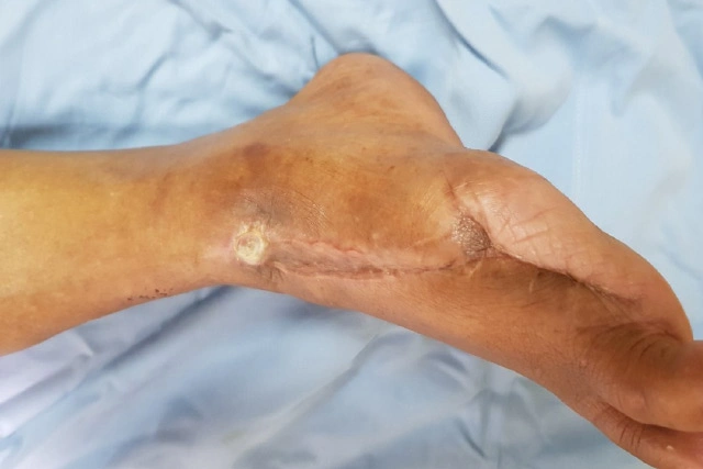 Dr. Diego García Caballero atención especializada en pie diabético, angiología, cirugía vascular, heridas, quemaduras y terapia VAC