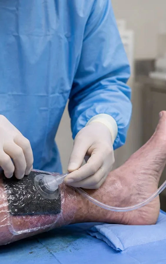 Dr. Diego García Caballero atención especializada en pie diabético, angiología, cirugía vascular, heridas, quemaduras y terapia VAC