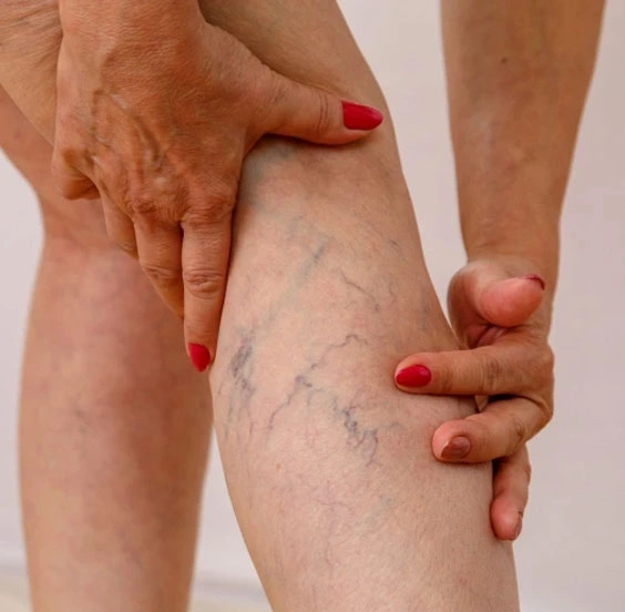 Dr. Diego García Caballero atención especializada en pie diabético, angiología, cirugía vascular, heridas, quemaduras y terapia VAC