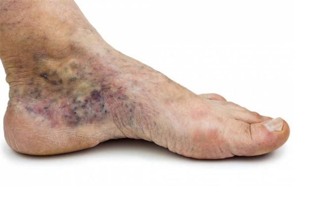 Dr. Diego García Caballero atención especializada en pie diabético, angiología, cirugía vascular, heridas, quemaduras y terapia VAC